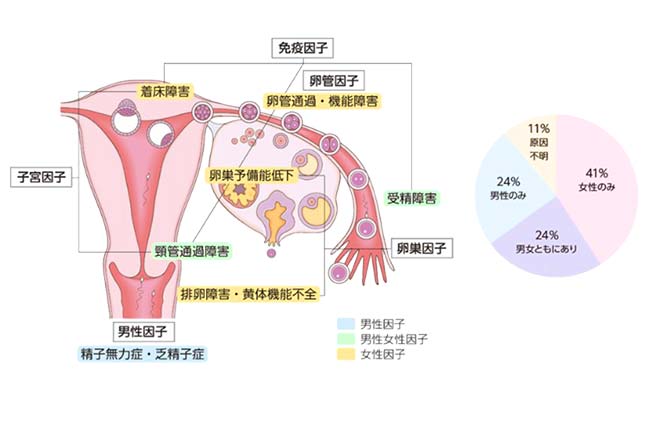 不妊症の原因