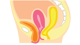 膀胱瘤